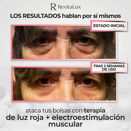 Antienvejecimiento de uso domestico | RevitaLux